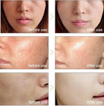 Skin whitening Oil for face & body